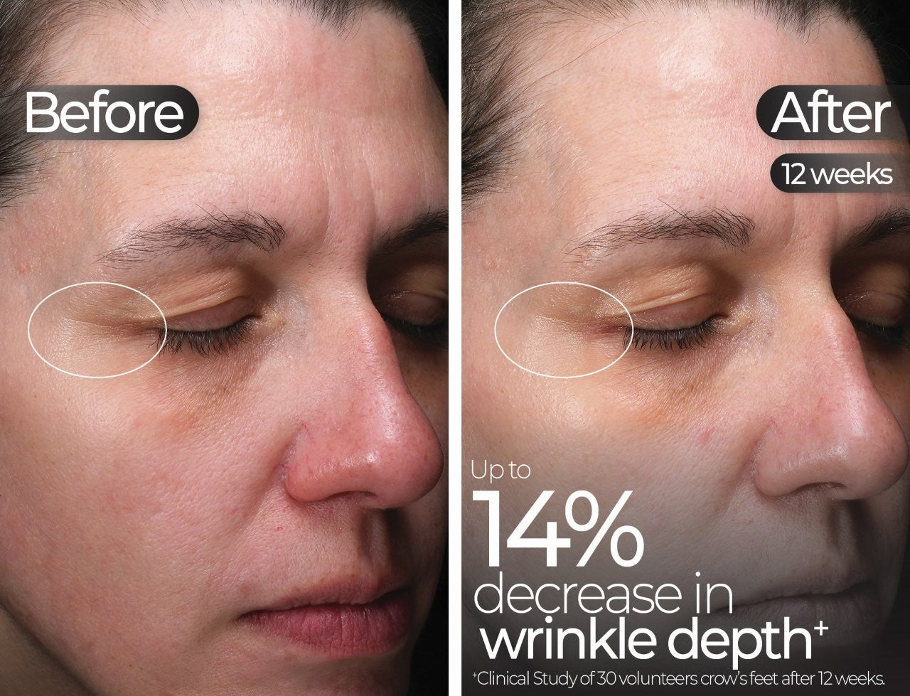 Wavelength Pro 5-in-1 LED Mask