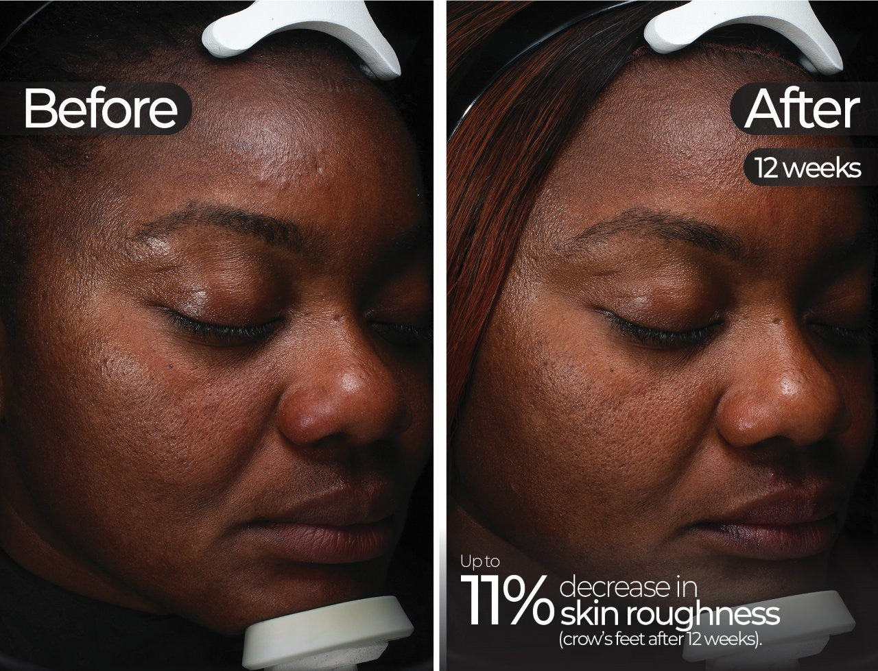 Wavelength Pro 5-in-1 LED Mask