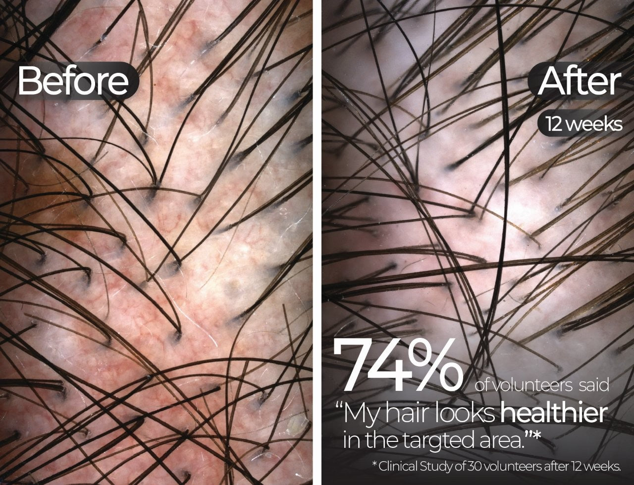 Wavelength Pro 5-in-1 LED Mask