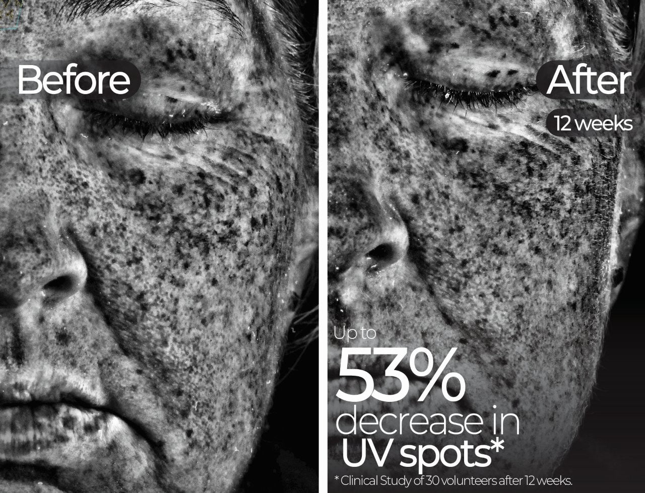 Wavelength Pro 5-in-1 LED Mask