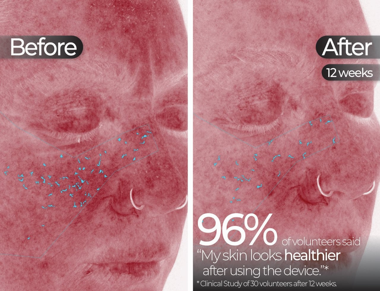 Wavelength Pro 5-in-1 LED Mask