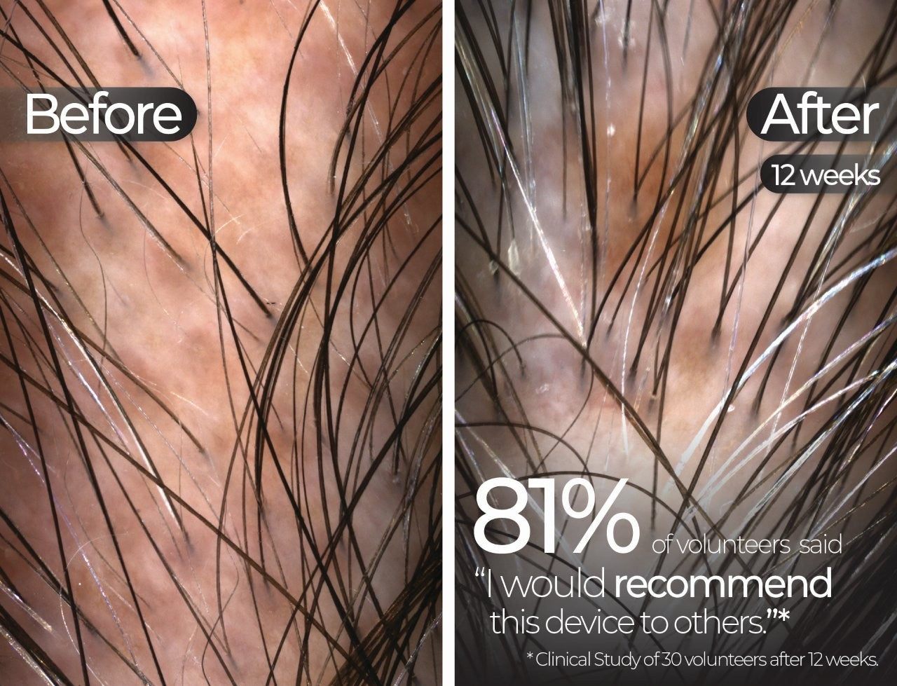 Wavelength Pro 5-in-1 LED Mask