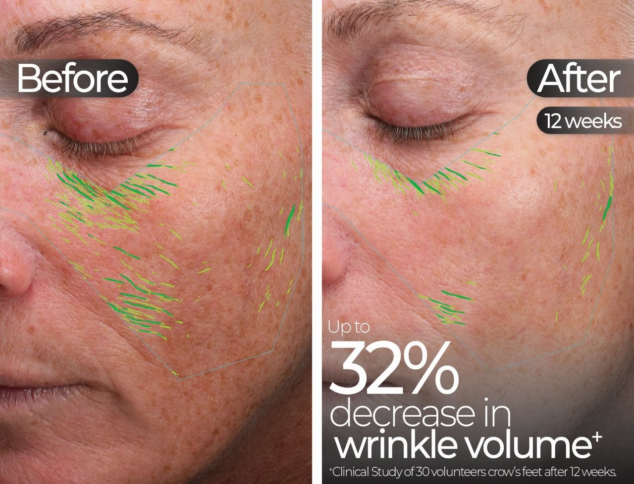 Wavelength Pro 5-in-1 LED Mask