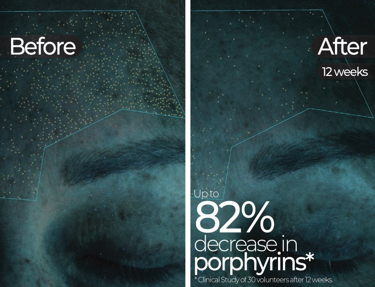 Wavelength Pro 5-in-1 LED Mask