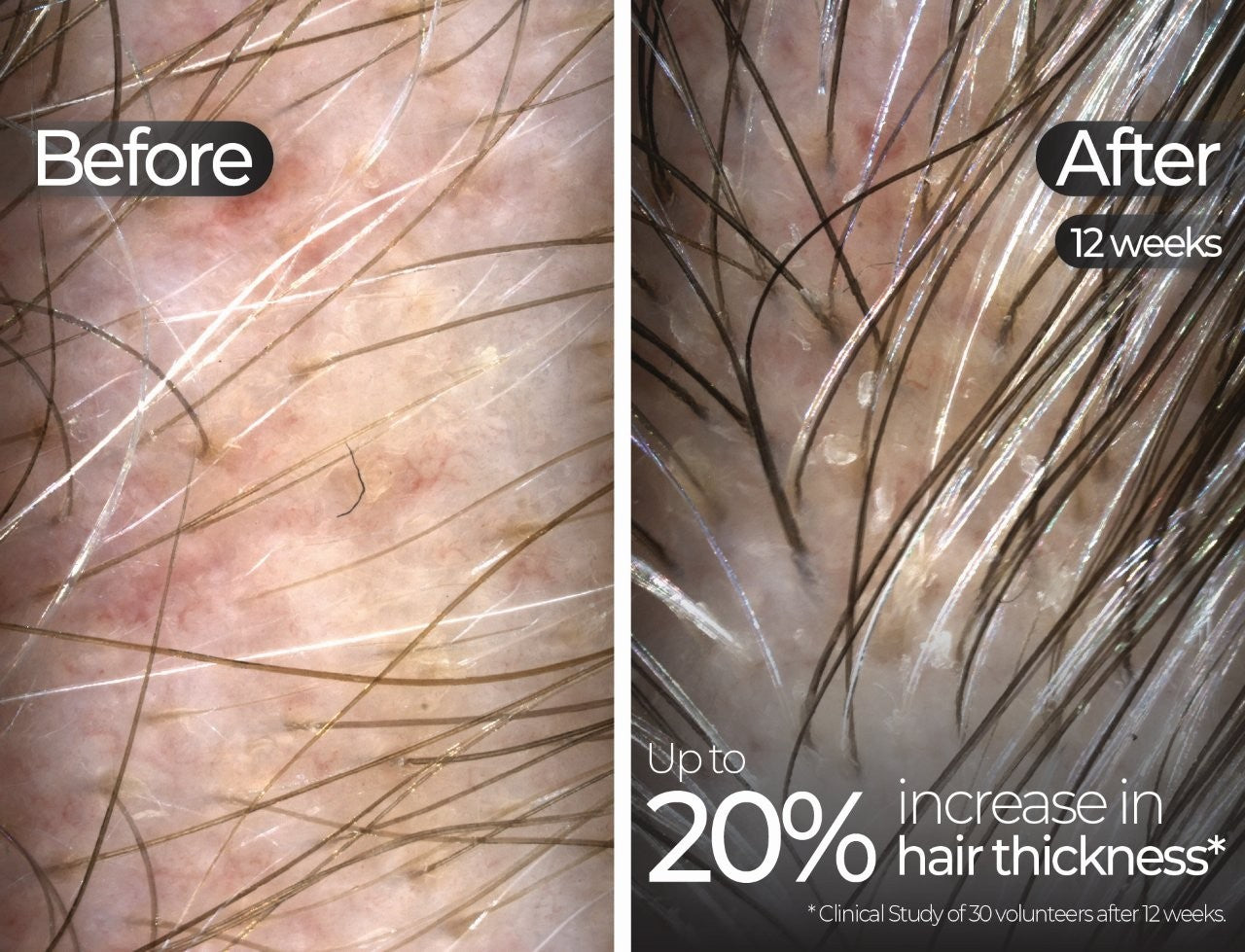 Wavelength Pro 5-in-1 LED Mask