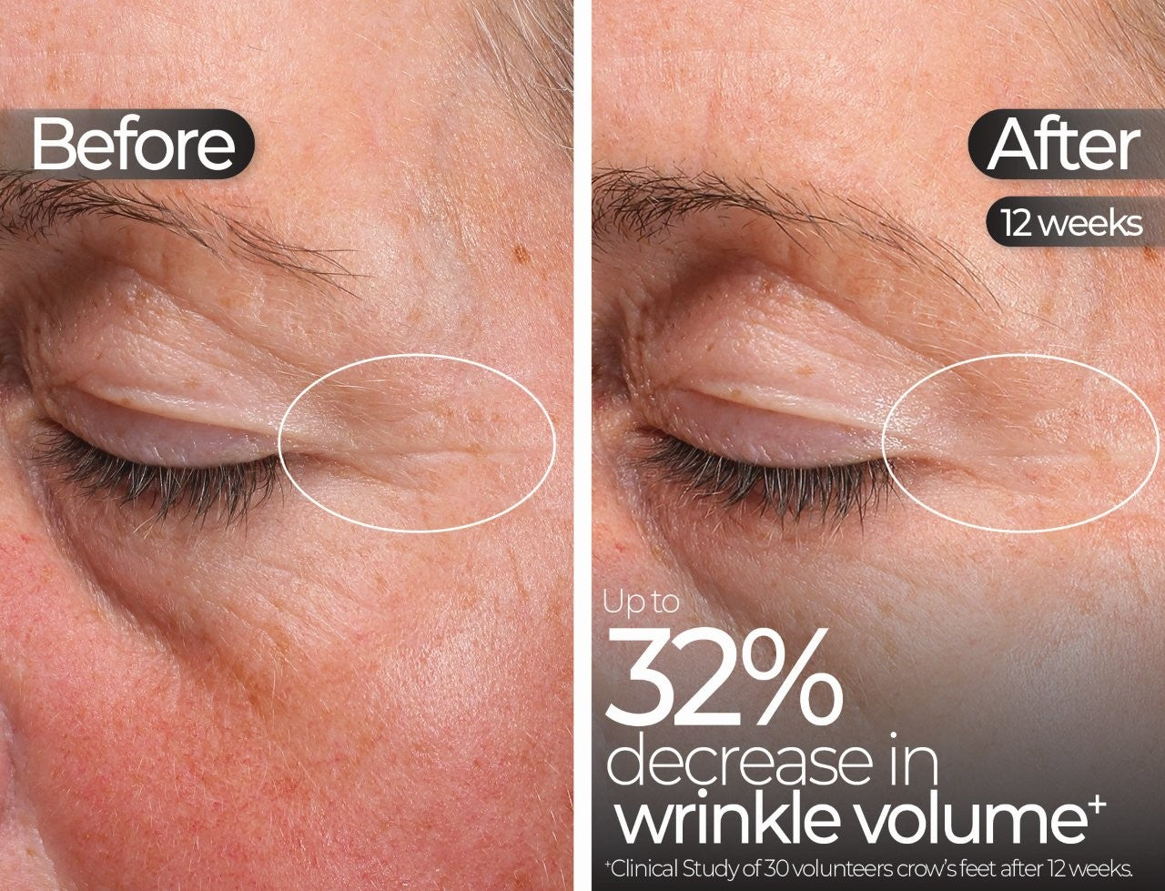 Wavelength Pro 5-in-1 LED Mask