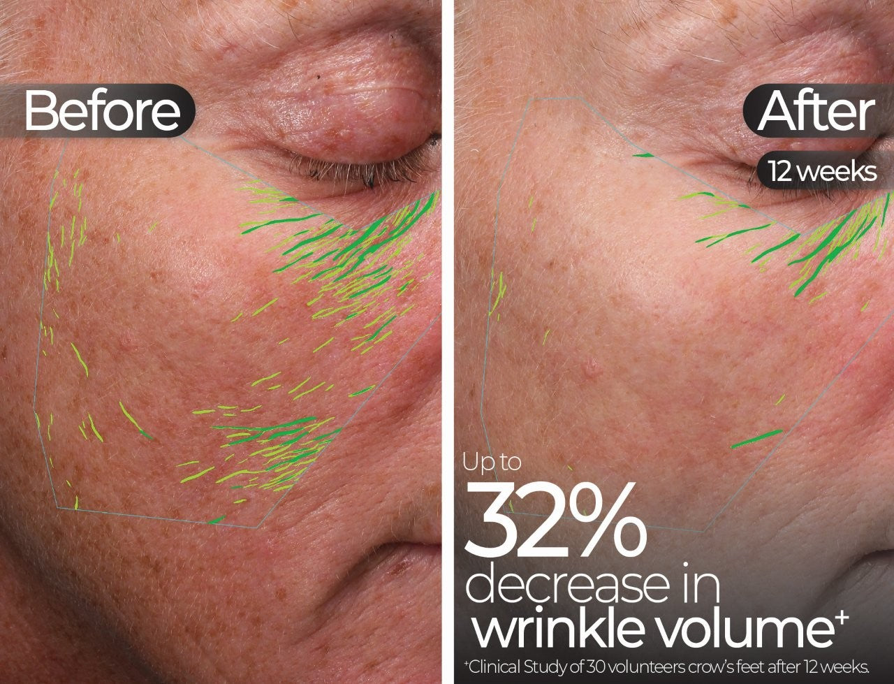 Wavelength Pro 5-in-1 LED Mask