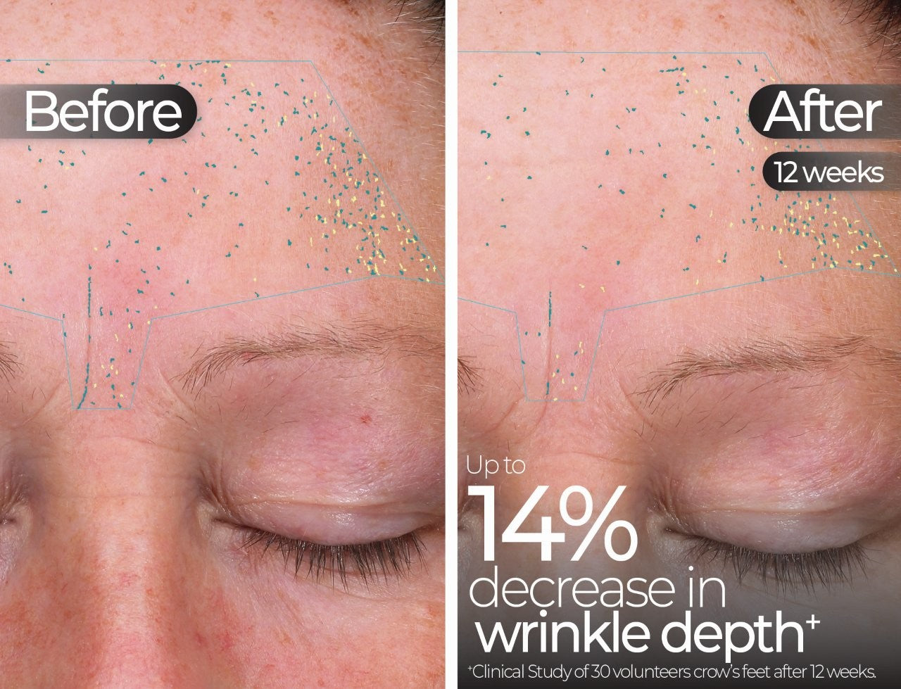 Wavelength Pro 5-in-1 LED Mask