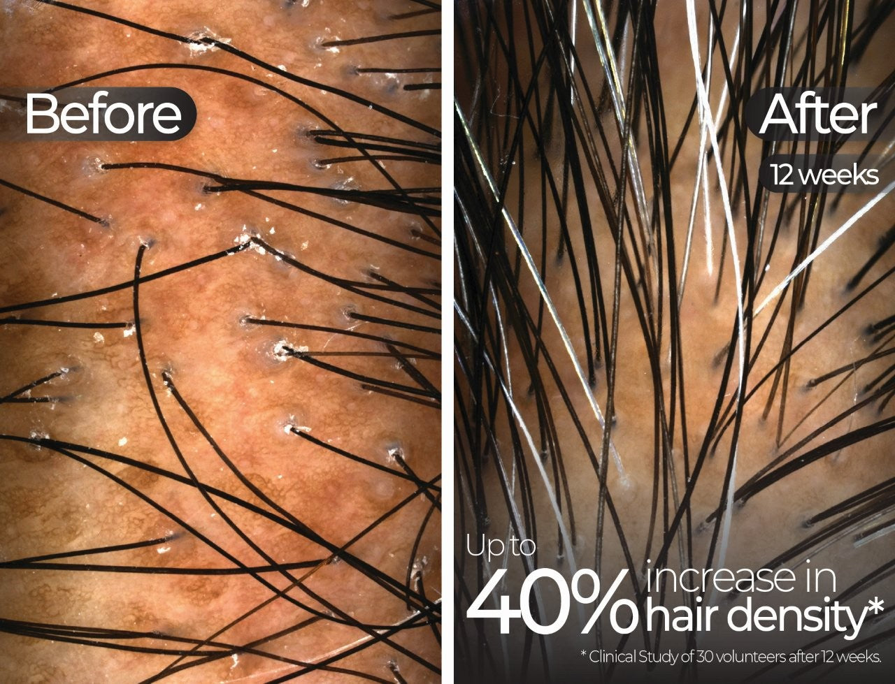 Wavelength Pro 5-in-1 LED Mask