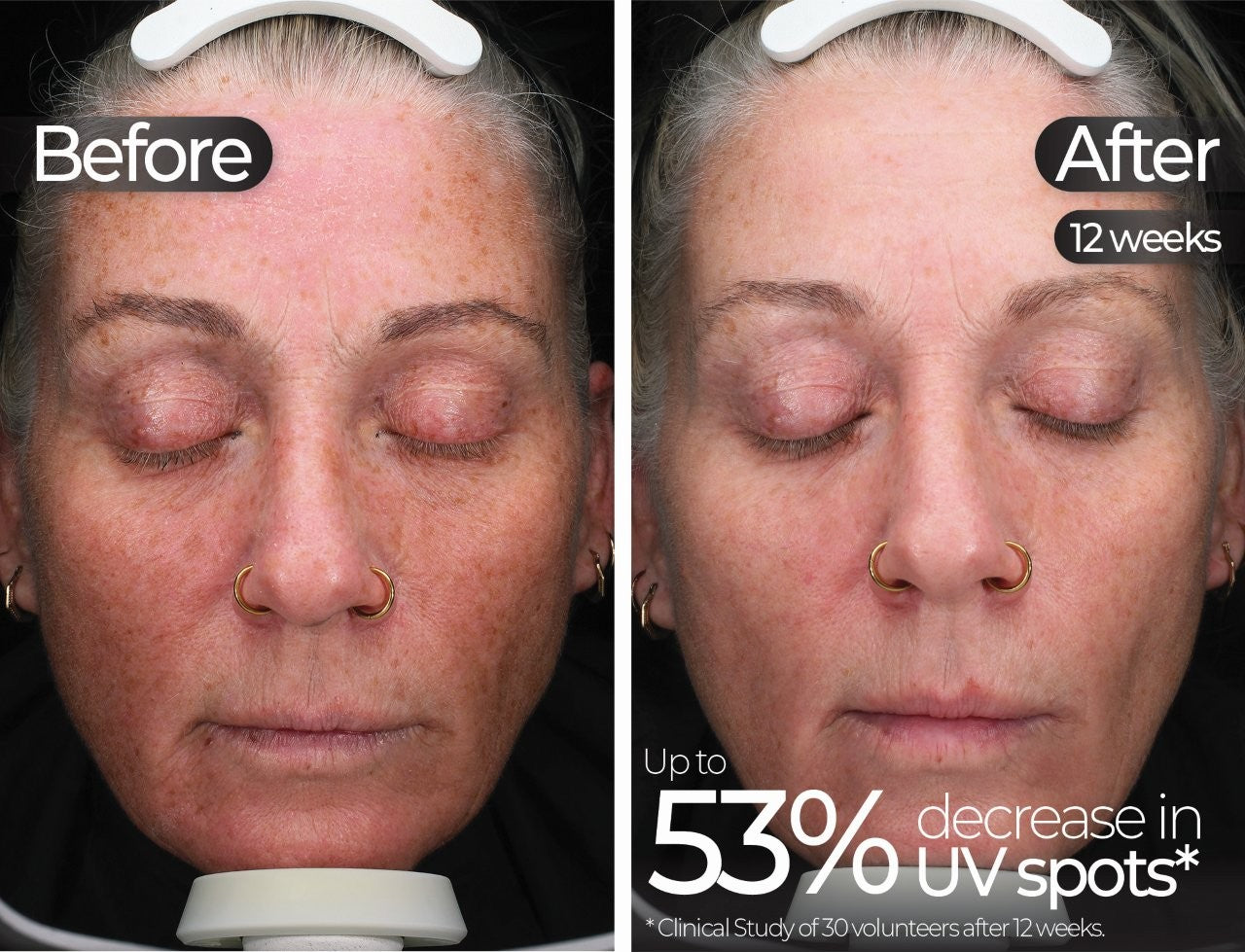 Wavelength Pro 5-in-1 LED Mask